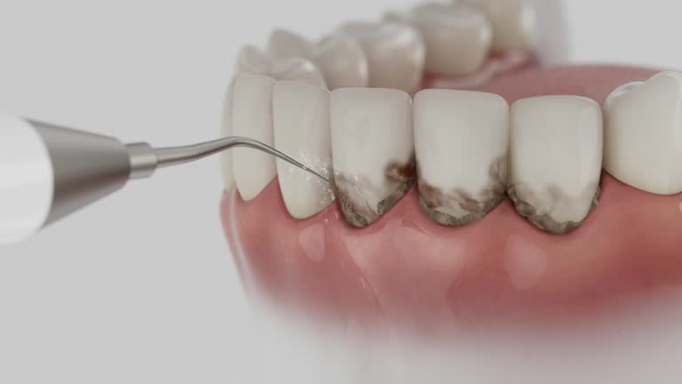 Reliable Emergency Dentist contractor in Gladstone, MI by Smile Center Dentistry